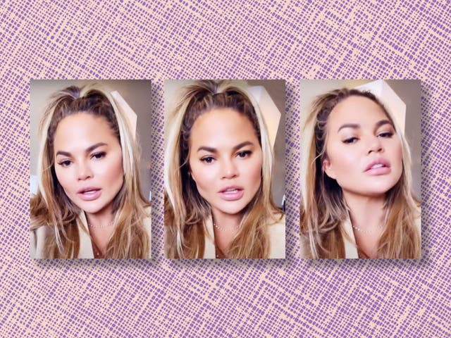 <p>‘I did that buccal fat removal thing’: Chrissy Teigen on Instagram in late 2021</p>