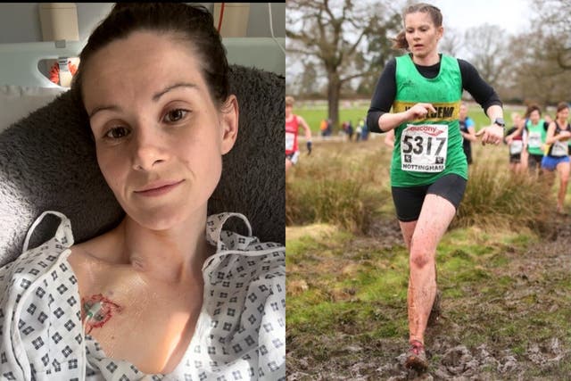 Abigail Snowball, 29, is unable to urinate or have single bite of food (Collect/PA Real Life)