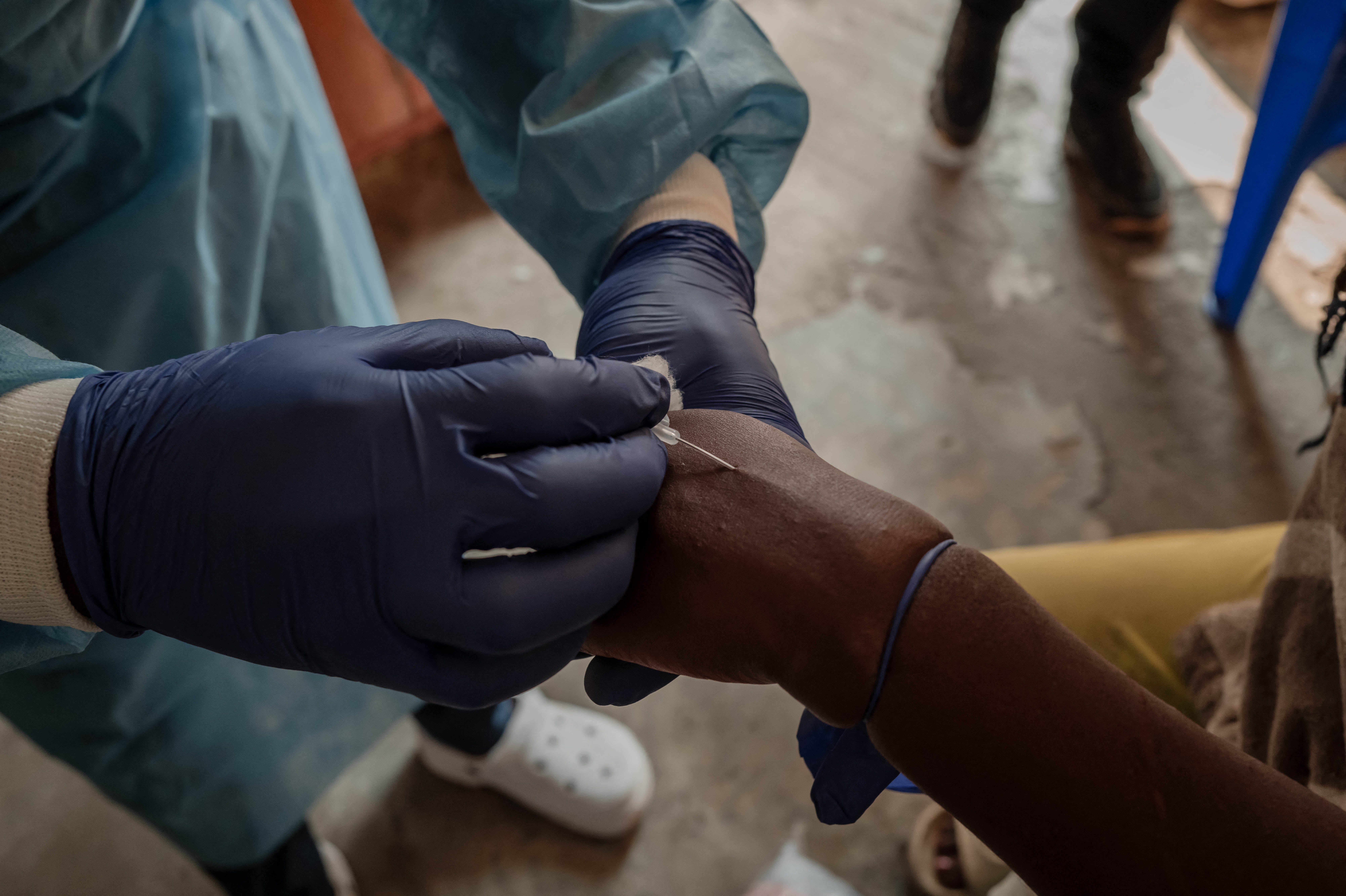 A health worker takes a sample at the mpox treatment centre of the Nyiragongo general referral hospital, north of the town of Goma in the Democratic Republic of Congo, on 16 August 2024