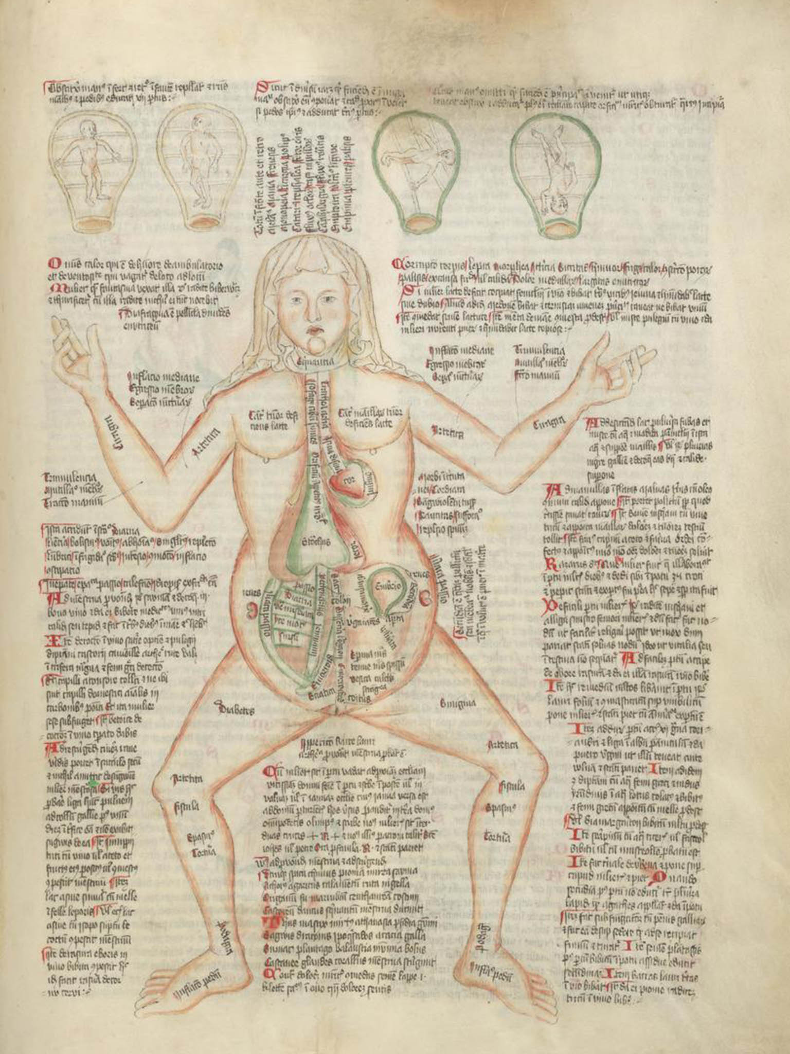 The ‘Disease Woman’ according to 15th century physicians